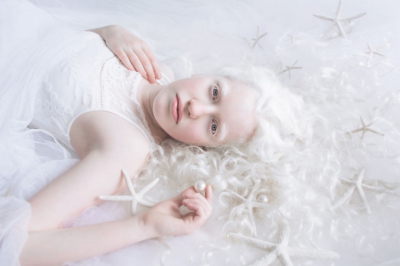 Vẻ đẹp “thôi miên” của người bệnh bạch tạng qua bàn tay nhiếp ảnh gia Yulia Taits